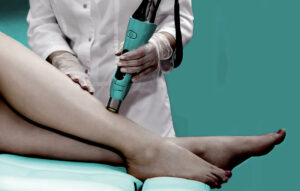 Laser Hair Removal in Humble TX